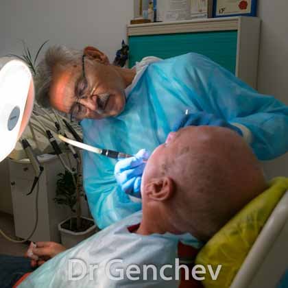 Д-р Генчев имплантация на пациент с базални зъбни импланти