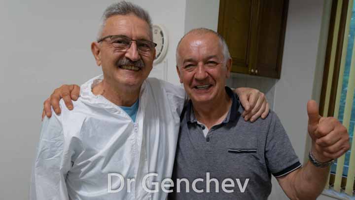 пациент с бруксизъм след базални импланти в Пловдив Др Генчев