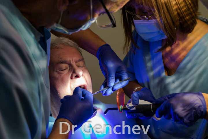 др Генчев постави базален зъбен имплант