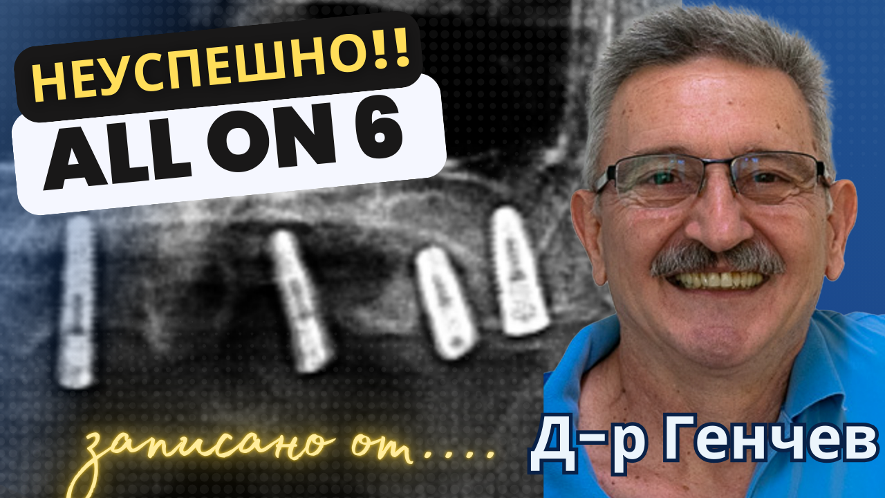 видео на неуспешен All-on-6
и е успешно лекувана с базални импланти от Д-р Генчев